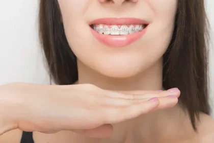 braces
